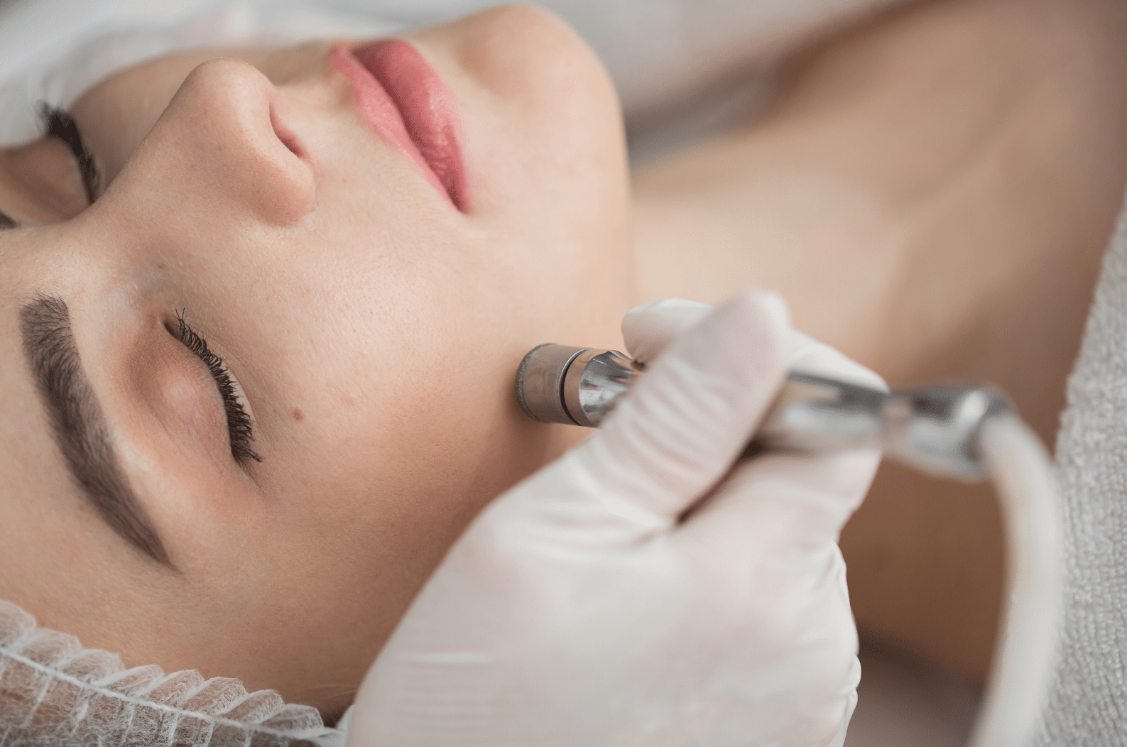 Microdermabrasion facial