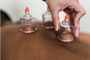 What's Cupping Massage? A Guide to Cupping Marks and the Cupping Massage Color