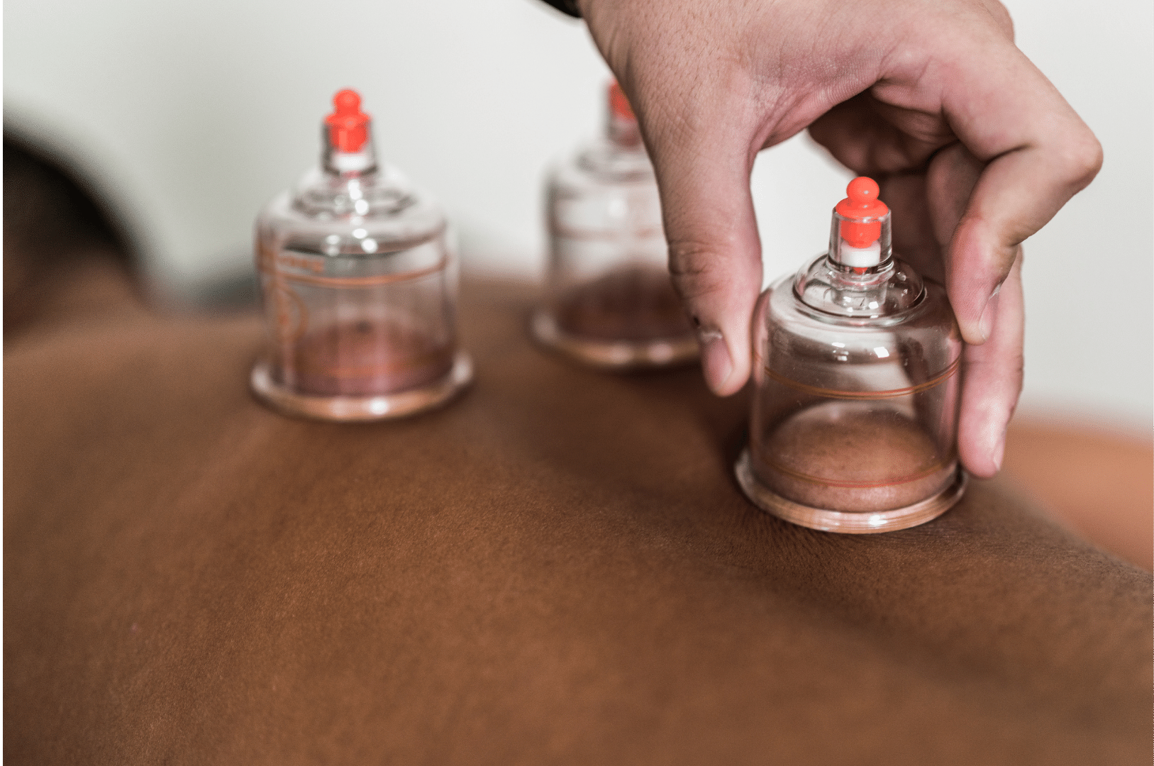 What's Cupping Massage? A Guide to Cupping Marks and the Cupping Massage Color