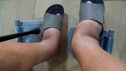 Lymphedema, and Dry Skin