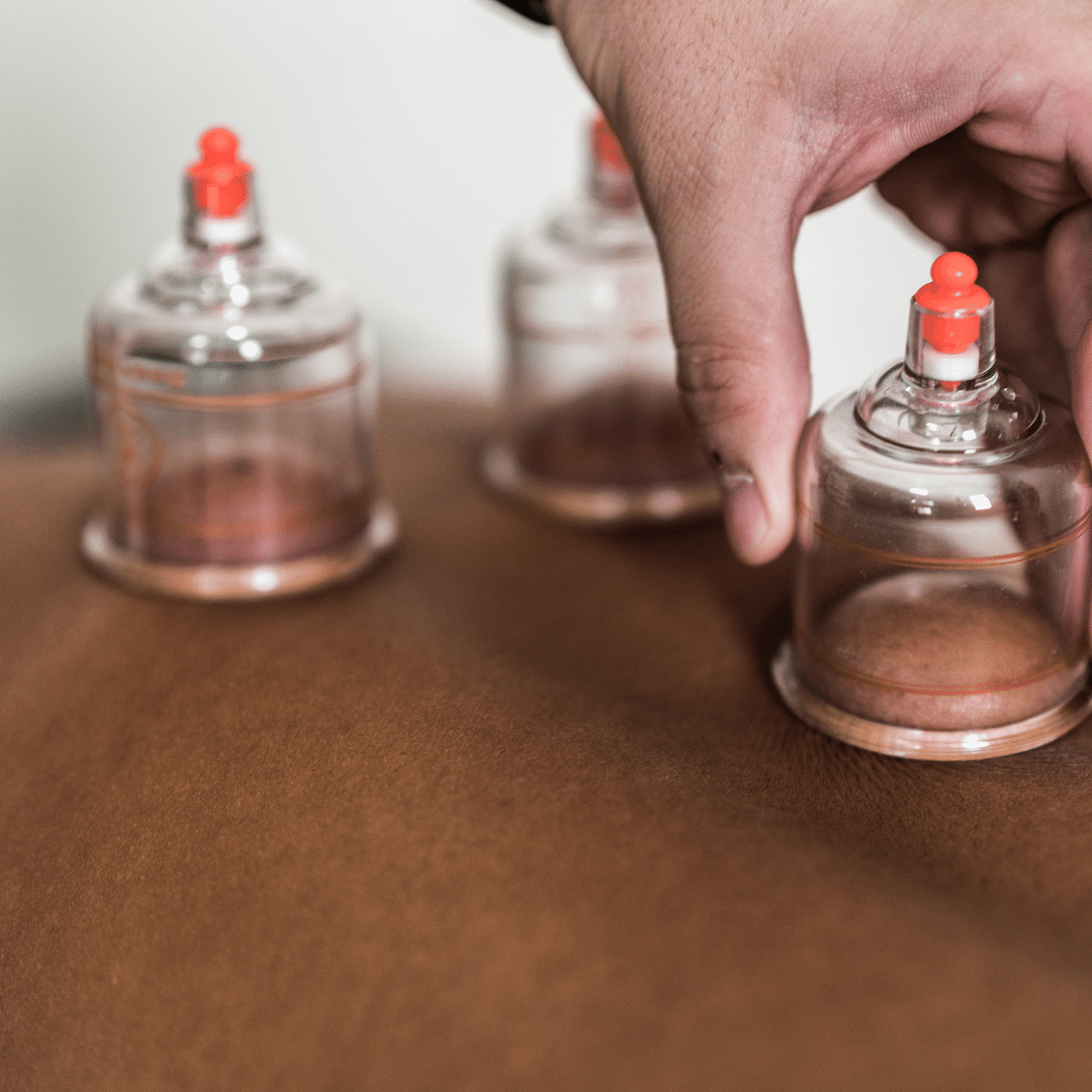 What's Cupping Massage? A Guide to Cupping Marks and the Cupping Massage Color